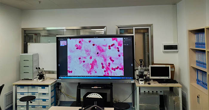 明美显微镜相机助力深圳市宝安区妇幼保健院细菌观察