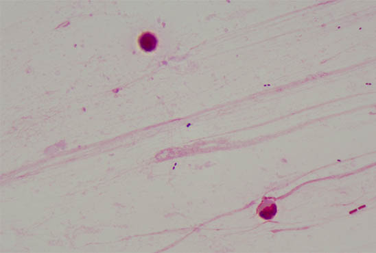 显微镜相机下的细菌2.jpg