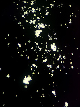 金相显微镜下的头孢类晶体