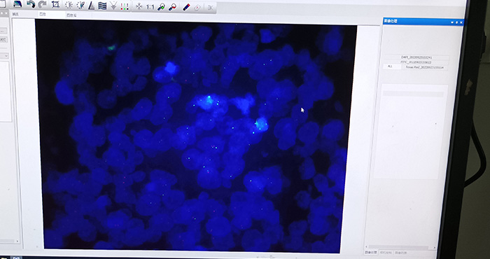 研究级荧光显微镜2.jpg