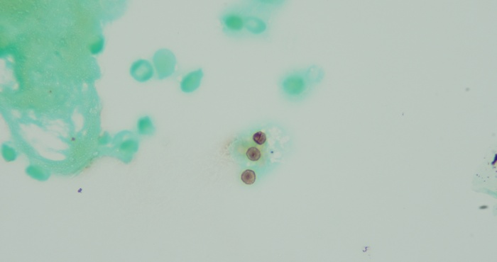 明美倒置生物显微镜用于染色样本观察