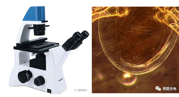 倒置显微镜-螨虫.jpg