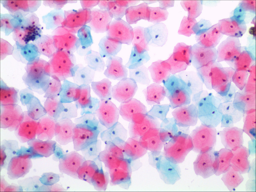 显微成像中的TCT薄层液基细胞学检查|应用百科