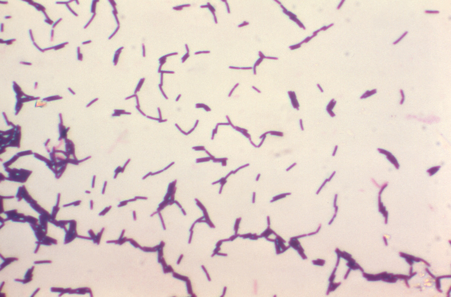 08_Bacillus.jpg