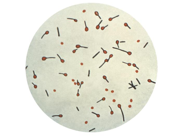 生物显微镜下的破伤风梭菌观察