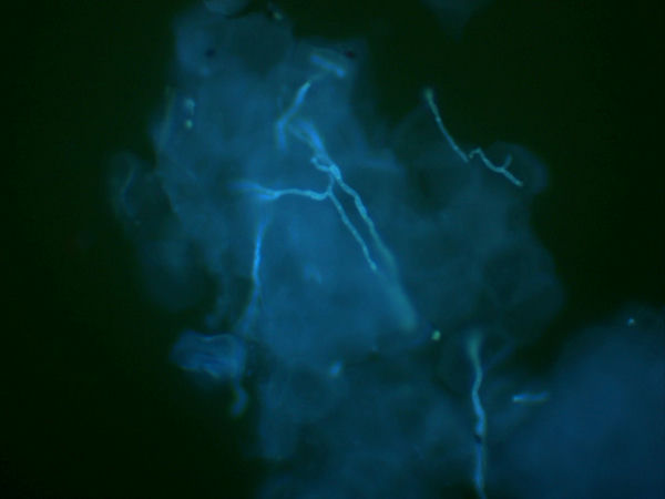 荧光生物显微镜助力皮肤科快速检查真菌感染