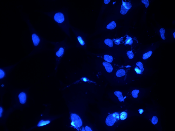 荧光显微镜下的细胞核