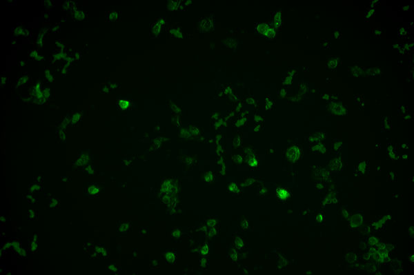 荧光生物显微镜MF43-M助力FISH技术与癌症诊断